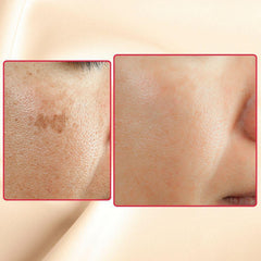 The Eraser Spot Cream | Dark Spot Corrector