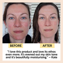 Anti-Aging Skincare Bundle
